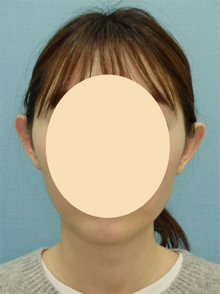 立ち耳が目立つ要因を左右するヘアスタイルや撮影条件