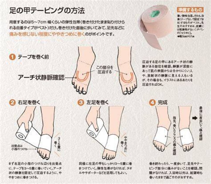 足の甲の打撲にテーピング｜正しい巻き方と注意点を徹底解説